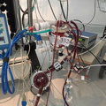 ECMO
